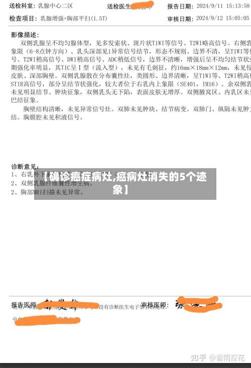 【确诊癌症病灶,癌病灶消失的5个迹象】-第2张图片