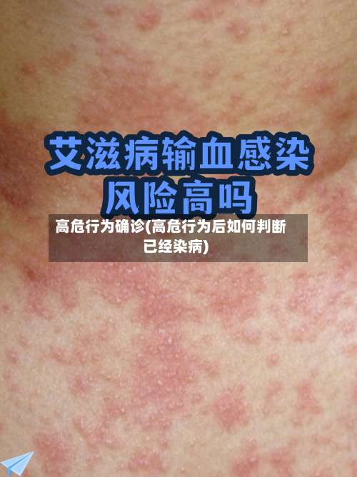 高危行为确诊(高危行为后如何判断已经染病)-第2张图片