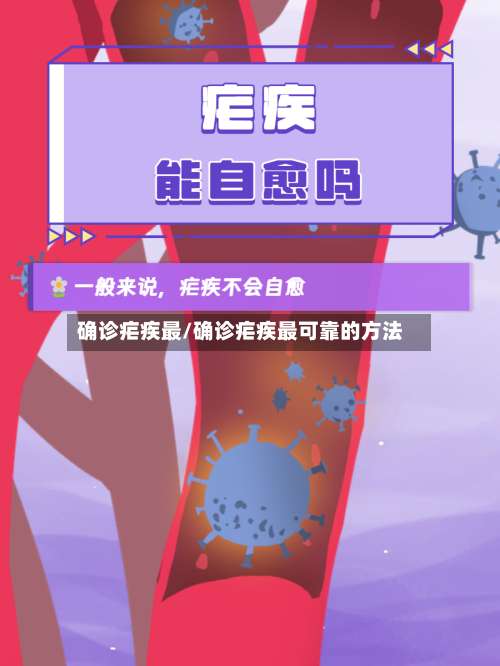确诊疟疾最/确诊疟疾最可靠的方法-第2张图片
