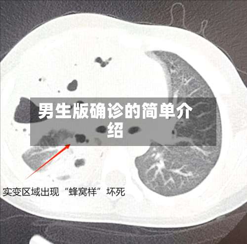 男生版确诊的简单介绍-第2张图片