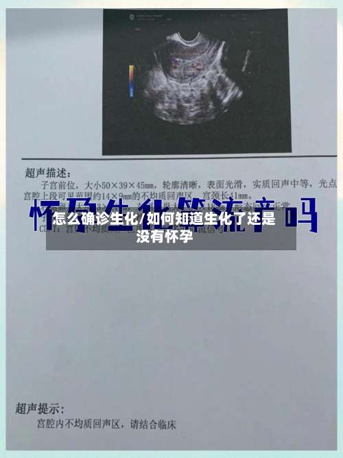 怎么确诊生化/如何知道生化了还是没有怀孕