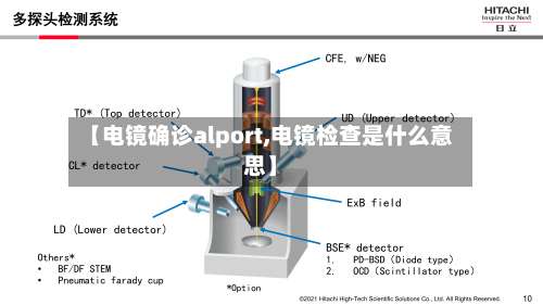 【电镜确诊alport,电镜检查是什么意思】-第2张图片
