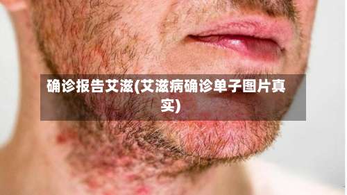 确诊报告艾滋(艾滋病确诊单子图片真实)