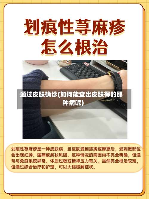 通过皮肤确诊(如何能查出皮肤得的那种病呢)-第3张图片