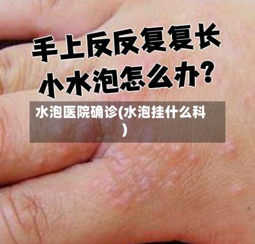 水泡医院确诊(水泡挂什么科)