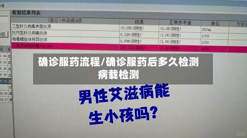 确诊服药流程/确诊服药后多久检测病载检测