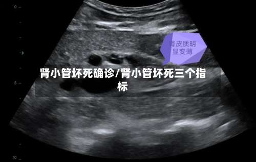 肾小管坏死确诊/肾小管坏死三个指标-第3张图片