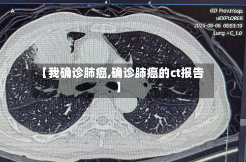 【我确诊肺癌,确诊肺癌的ct报告】